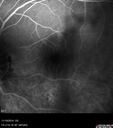 lamellarhole-sturgeweber_riham_111914_22.jpg
