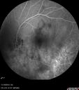 lamellarhole-sturgeweber_riham_111914_23.jpg