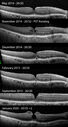 lamellarhole-sturgeweber_riham_111914_24.jpg