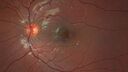 laser_116668_090523_02.jpg
