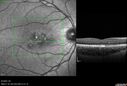 laser_116668_090523_15.jpg