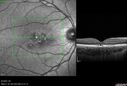laser_116668_090523_19.jpg