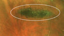 lattice-smc-circled.jpg