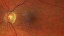 light-toxicity_118445_012624_02.jpg