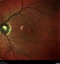 light-toxicity_118445_012624_04.jpg