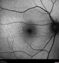 light-toxicity_118445_012624_05.jpg