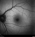 light-toxicity_118445_012624_06.jpg