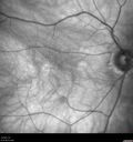 light-toxicity_118445_012624_07.jpg