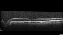 light-toxicity_118445_012624_10.jpg
