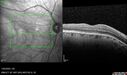 light-toxicity_118445_012624_11.jpg