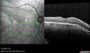 light-toxicity_118445_012624_12.jpg