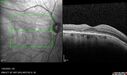 light-toxicity_118445_012624_14.jpg