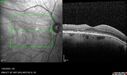 light-toxicity_118445_012624_15.jpg