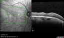 light-toxicity_118445_012624_16.jpg
