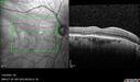 light-toxicity_118445_012624_17.jpg