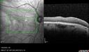 light-toxicity_118445_012624_18.jpg