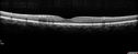 lymphoma_vija_120616_08.jpg