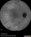 lymphoma_vija_120616_20.jpg