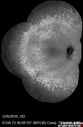 lymphoma_vija_120616_21.jpg