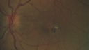 mactel_sudrew_052317_02.png