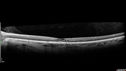 mactel_verymild_sai_012319_10.jpg
