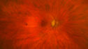 melanoma-mac_jamoc_010719_01.jpg