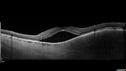 melanoma-mac_jamoc_010719_09.jpg