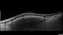 melanoma-mac_jamoc_010719_11.jpg