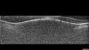 melanoma-mac_jamoc_010719_12.jpg