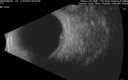 melanoma-mac_jamoc_010719_13.png