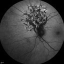 microaRPEdysgen_veba_052014_04.jpg