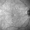microanwithoutBDR_edwe_020414_05.jpg