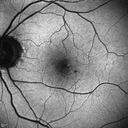 microanwithoutBDR_edwe_020414_08.jpg