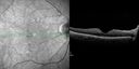microanwithoutBDR_edwe_020414_10.jpg