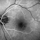 microanwithoutBDR_edwe_020414_14.jpg