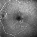 microanwithoutBDR_edwe_020414_17.jpg