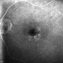 microanwithoutBDR_edwe_020414_18.jpg