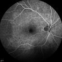 microanwithoutBDR_edwe_020414_21.jpg