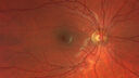 migraine_127207_092525_01.jpg