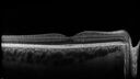 migraine_127207_092525_07.jpg