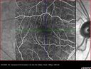 migraine_127207_092525_12.jpg