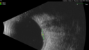 mm-small_122486_111424_06.png