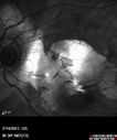 myope-rapidGA_frma_2018_02.jpg