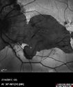myope-rapidGA_frma_2018_04.jpg