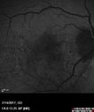 myope-rapidGA_frma_2018_05.jpg