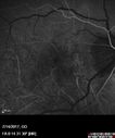 myope-rapidGA_frma_2018_06.jpg