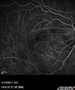 myope-rapidGA_frma_2018_09.jpg