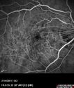 myope-rapidGA_frma_2018_13.jpg