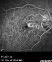 myope-rapidGA_frma_2018_14.jpg