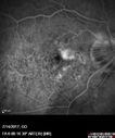 myope-rapidGA_frma_2018_15.jpg